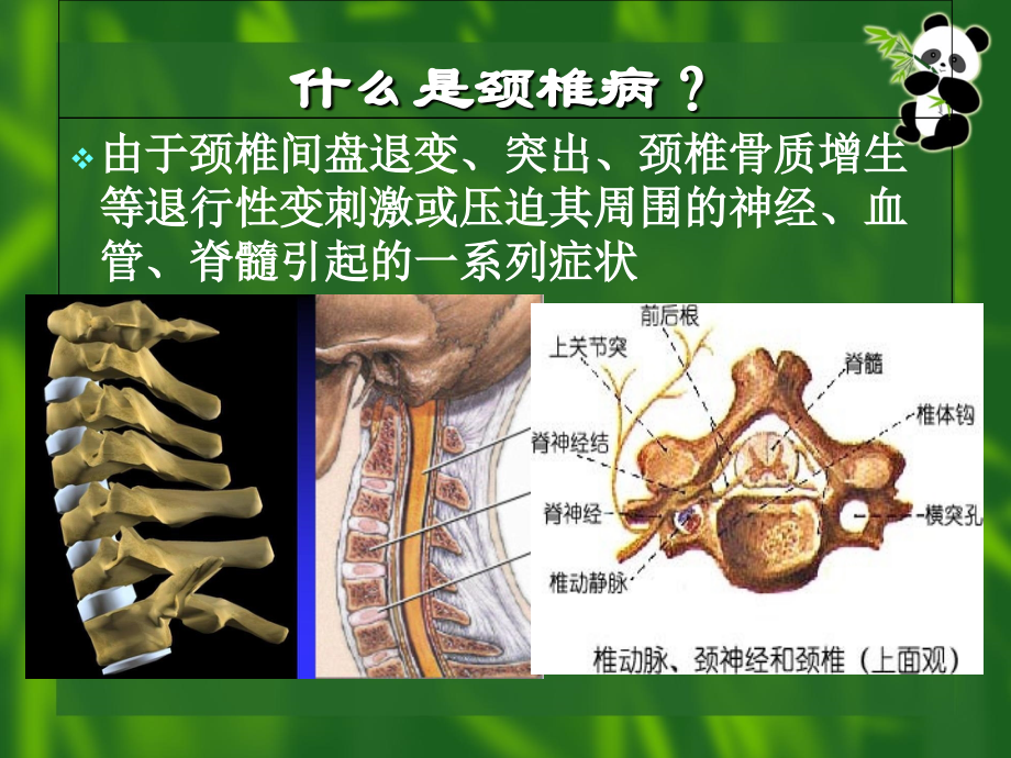 康复医学-颈椎病（）_第3页