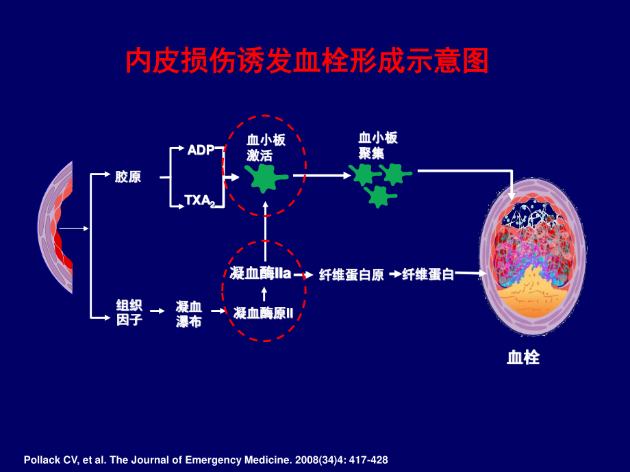 (沈杰)新型抗凝药物药学监护_第2页