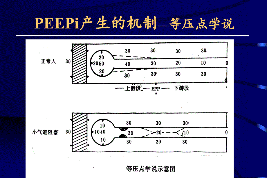 慢性阻塞性肺疾病的机械通气-1_第3页