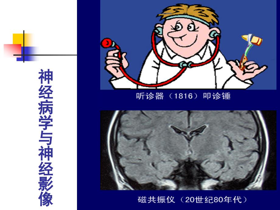 神经病学教学课件 失语失用_第2页