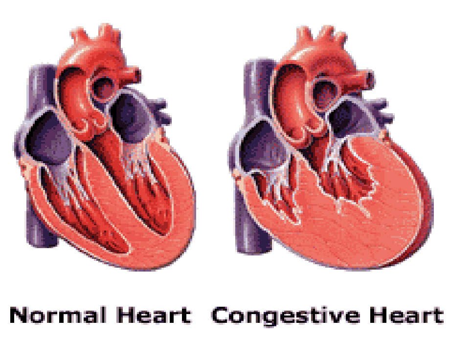 药理学（案例版） 心血管药理学_第3页
