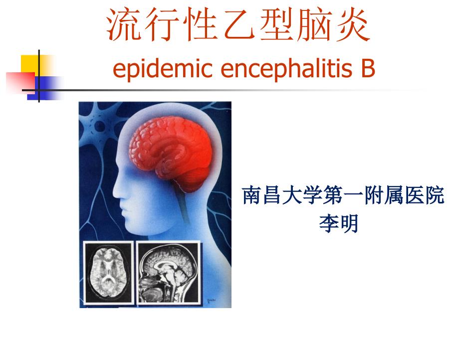 张伦理《传染病学》02-09 流行性乙型脑炎_第4页