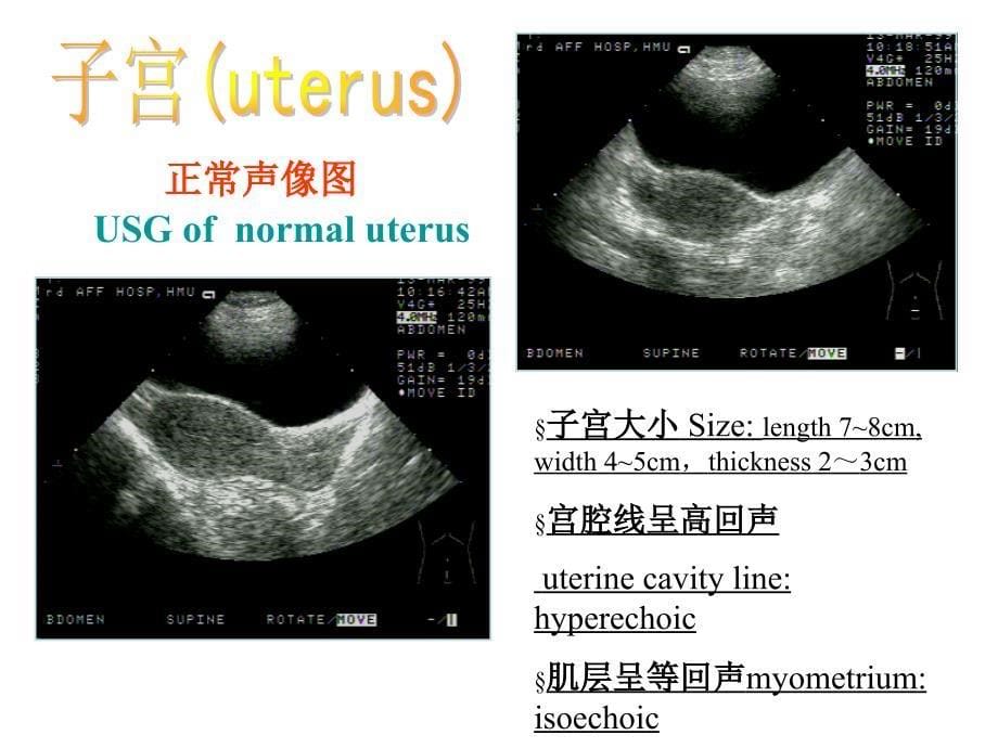 彩色多普勒超声的临床应用-1_第5页