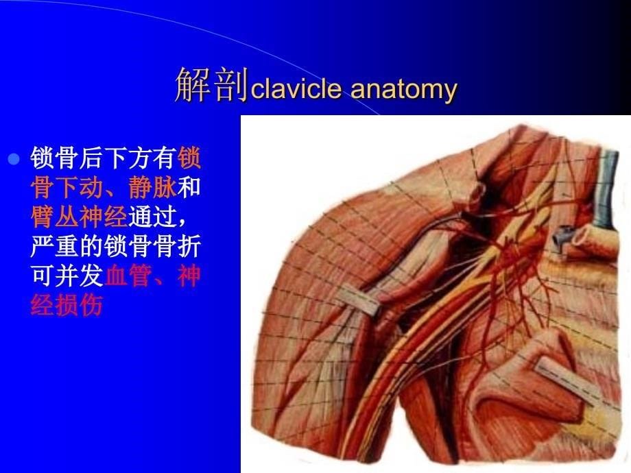 锁骨骨折诊断与治疗(图文)_第5页