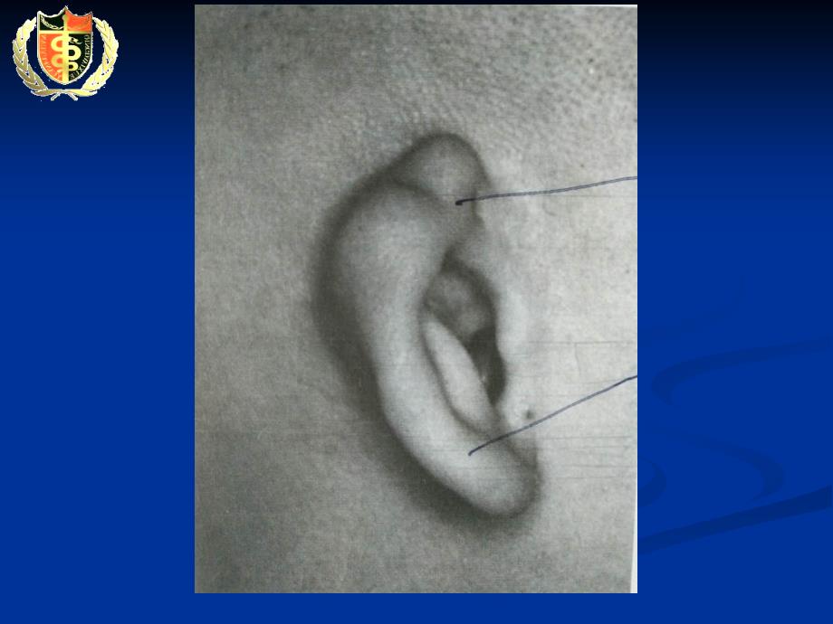 耳鼻咽喉头颈胚胎发育_第4页