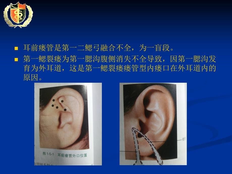 耳鼻咽喉头颈胚胎发育_第5页