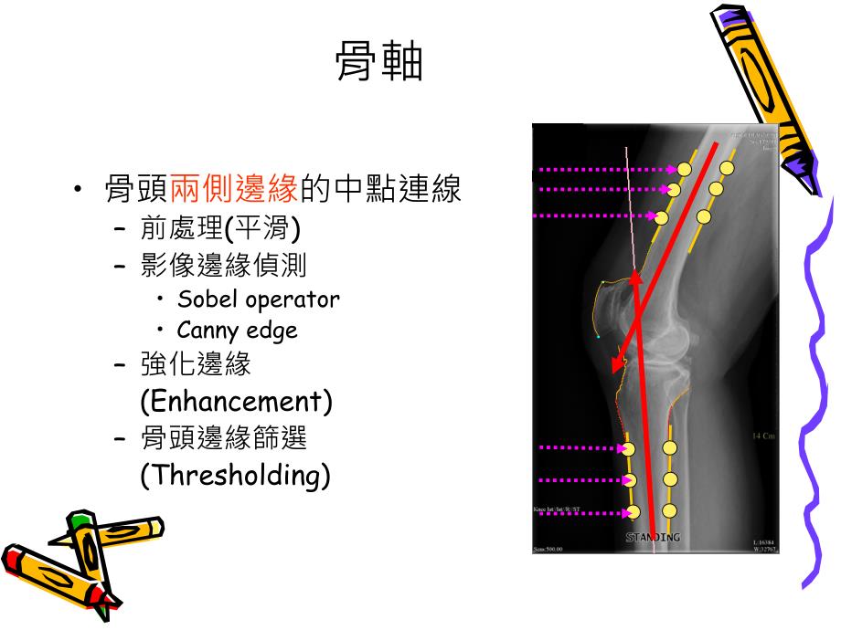 《醫療影像分析》ppt课件_第4页