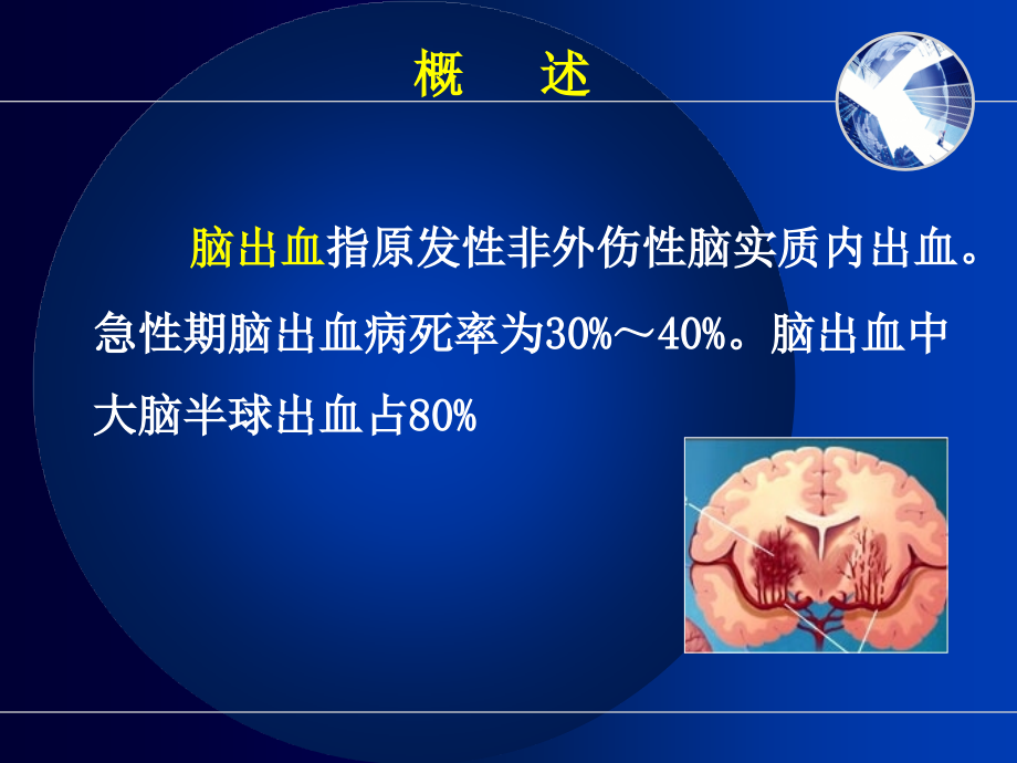 临床医学第二节急性脑血管疾病出血性_第4页