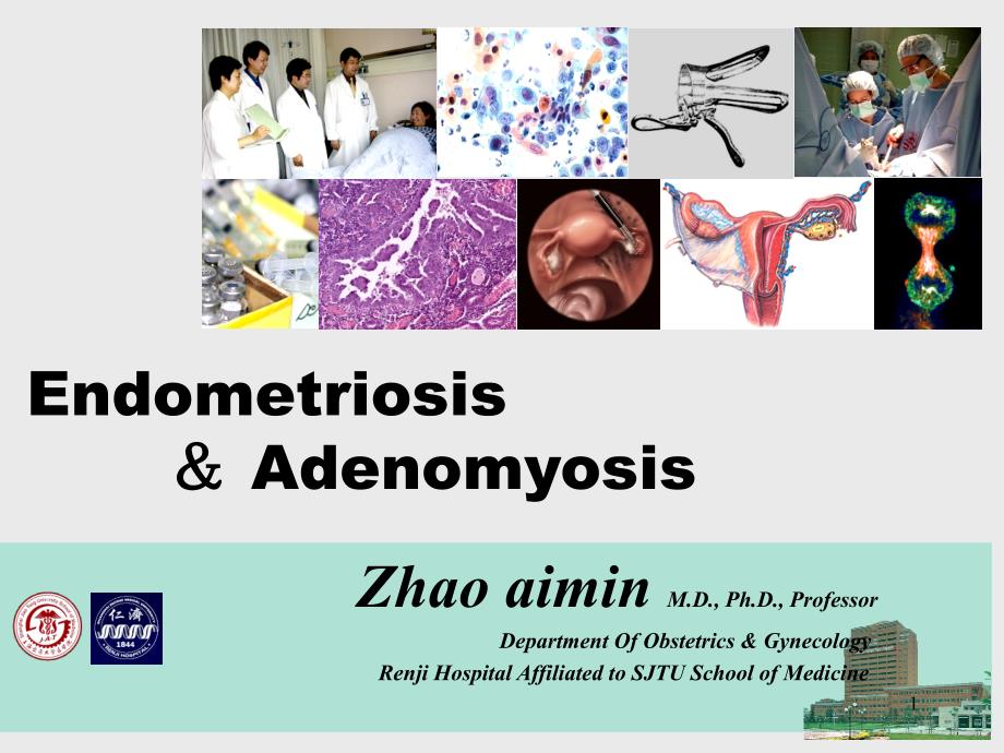 endometriosis＆adenomyosis-上海交通大学医学院精…（ppt-45）_第1页