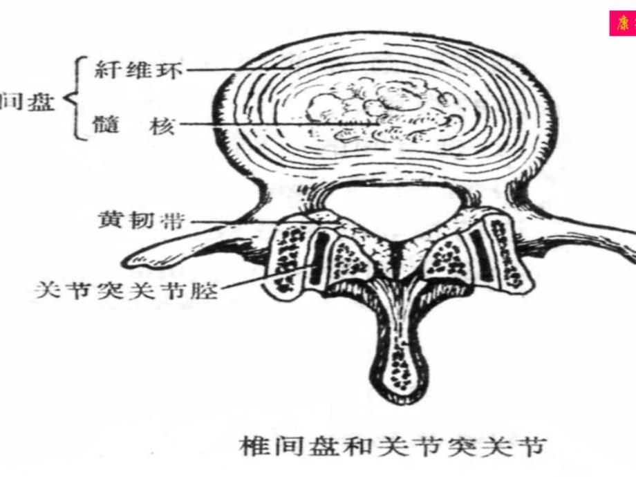 宝典腰间盘凸起症的康复治疗及相干题目-2_第4页