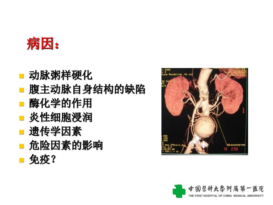 课件）-腹主动脉瘤的诊断与治疗_第3页