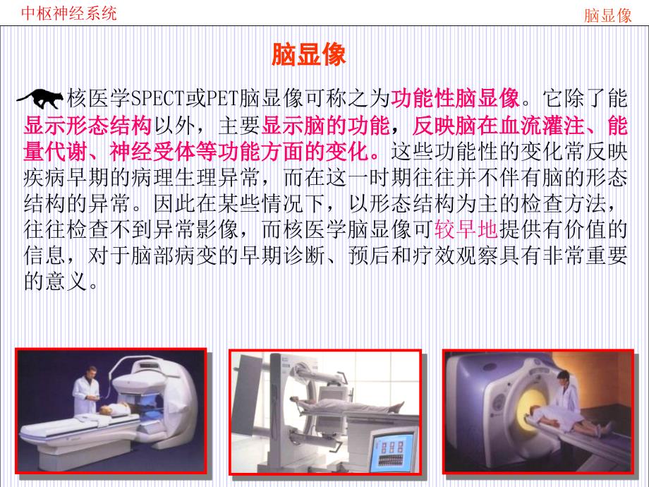 核医学课件）09.脑及脑池显像_第2页