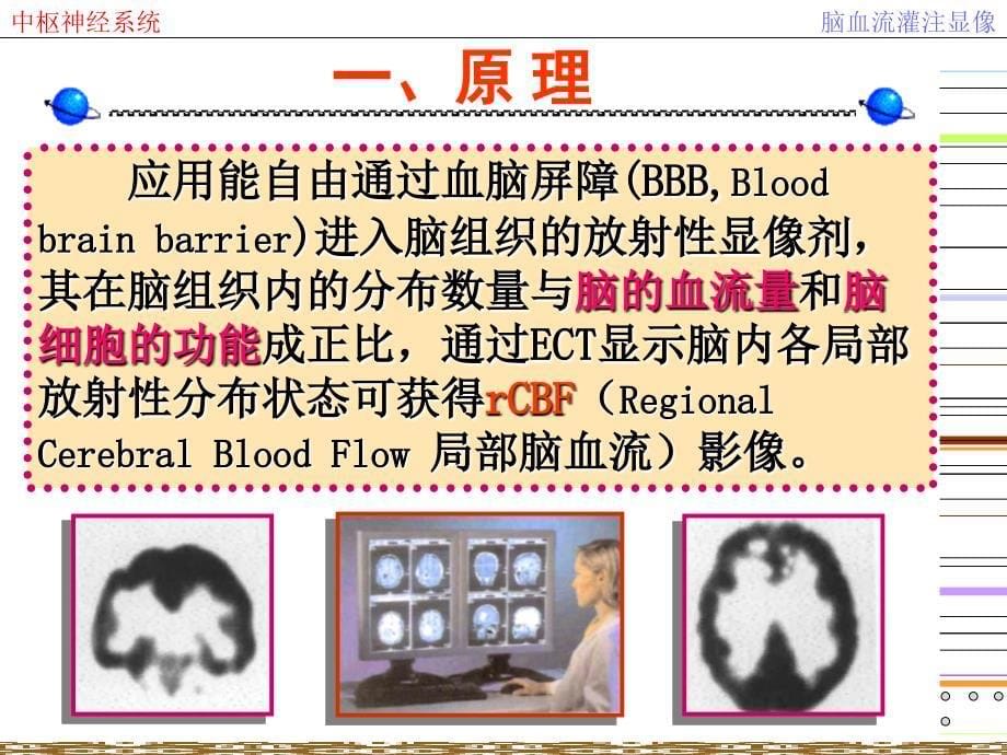 核医学课件）09.脑及脑池显像_第5页