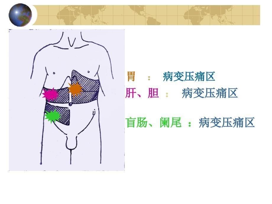 检体诊断学-陈海燕症状学腹痛_第5页