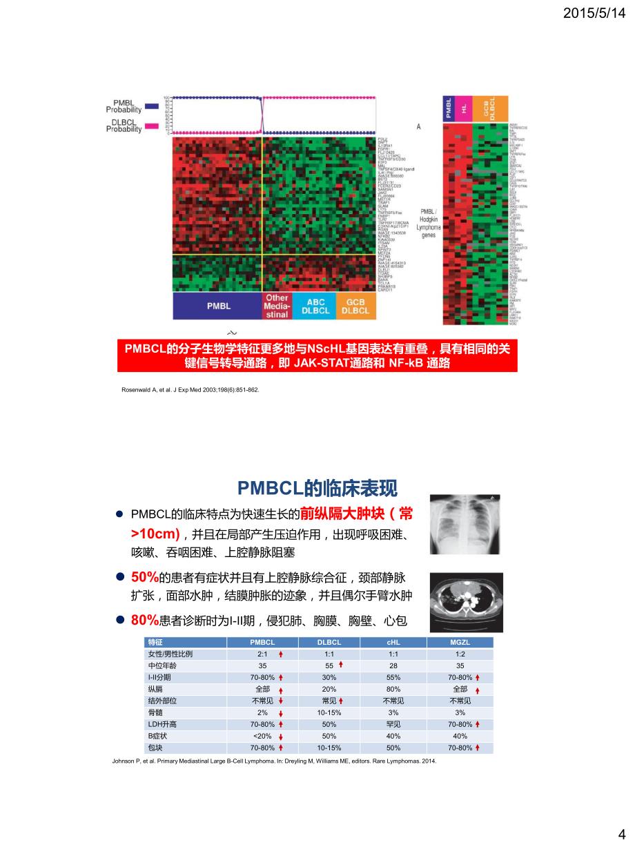 原发纵隔大b细胞淋巴瘤诊断和治疗_第4页