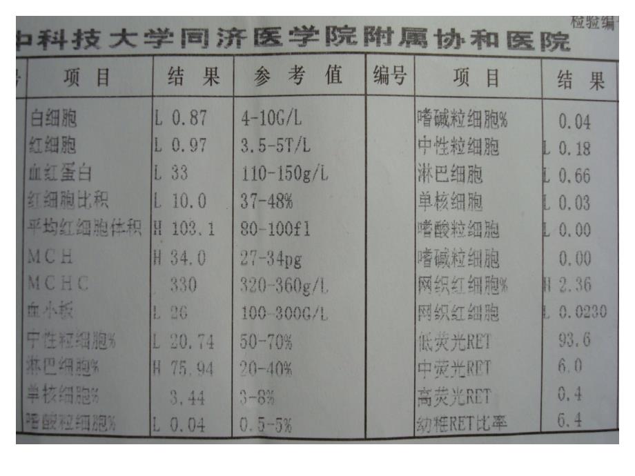 临床血液学和血液学检验-贫血(ma)_第2页