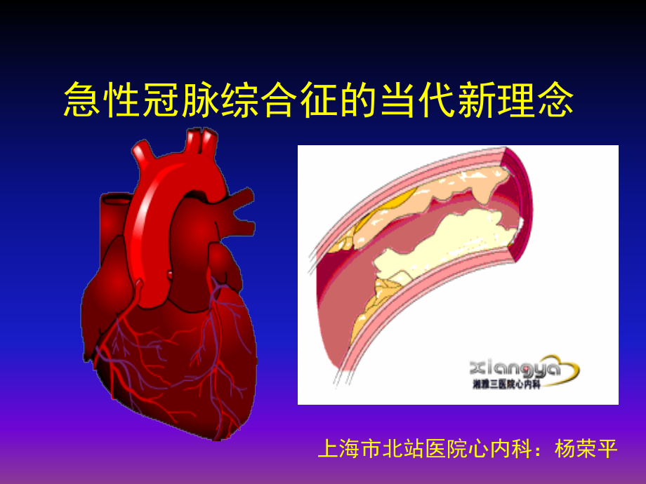 急性冠脉综合征的当代新理念(讲稿)_第1页