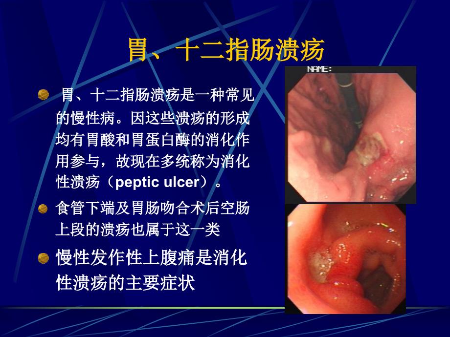 培训资料-腹部常见病变的主要症状和体征_第2页