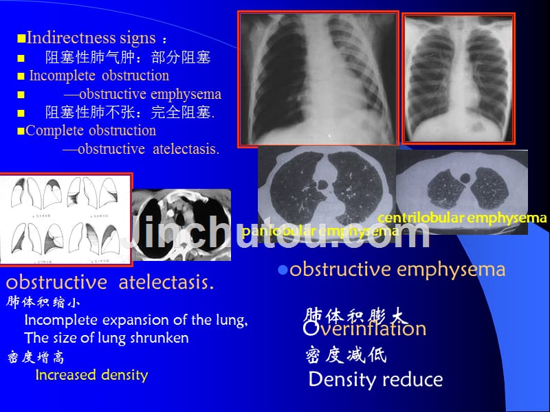 《呼吸系统影像诊断》ppt课件_第3页