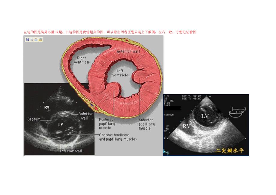 经典心脏超声及食管超声心动图及解剖的比较_第1页