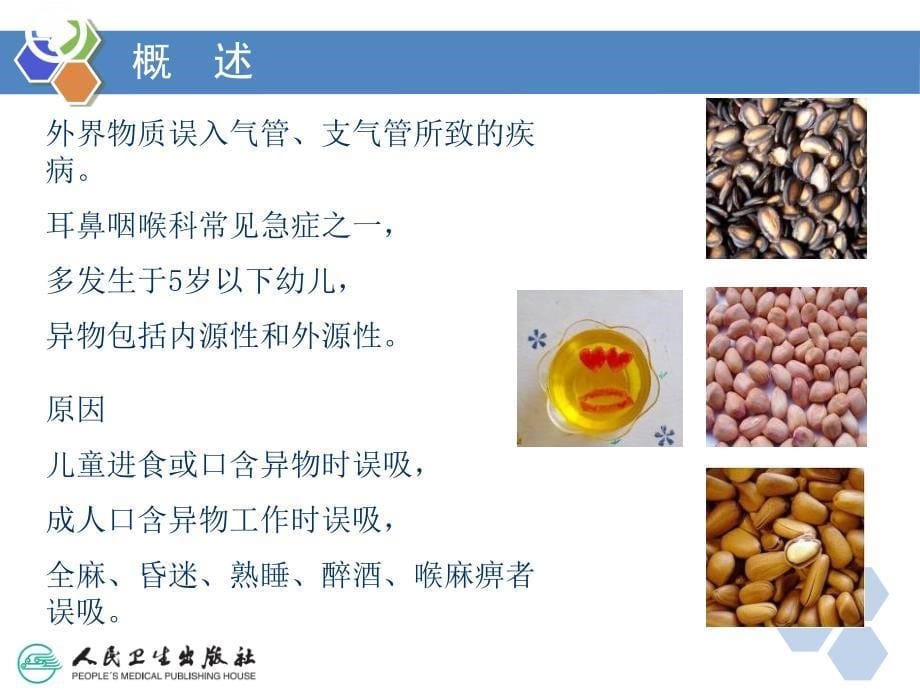 《气管与食管疾病》ppt课件_第5页