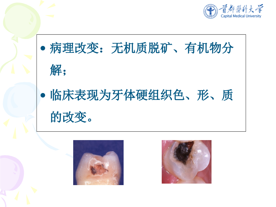 《牙体硬组织疾病》ppt课件_第4页