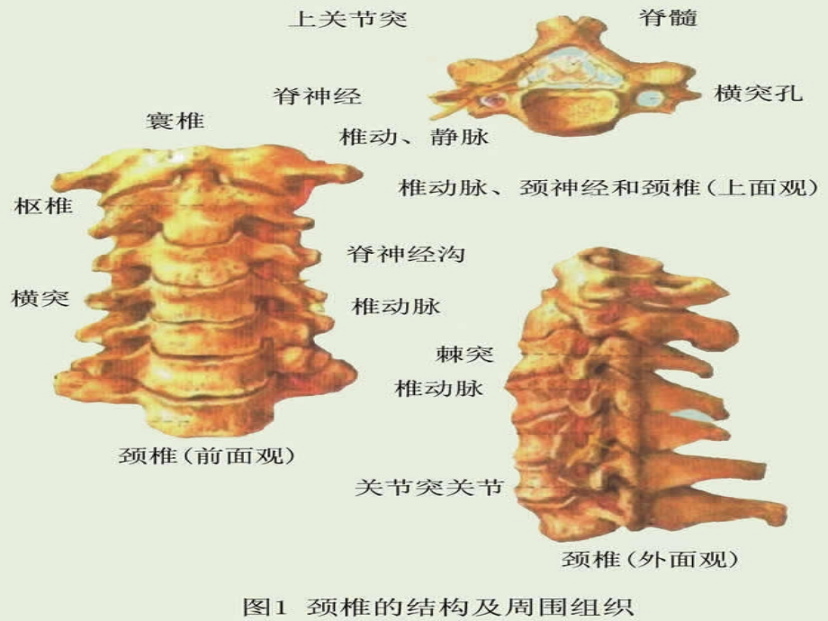 《颈椎x线诊断》ppt课件_第3页