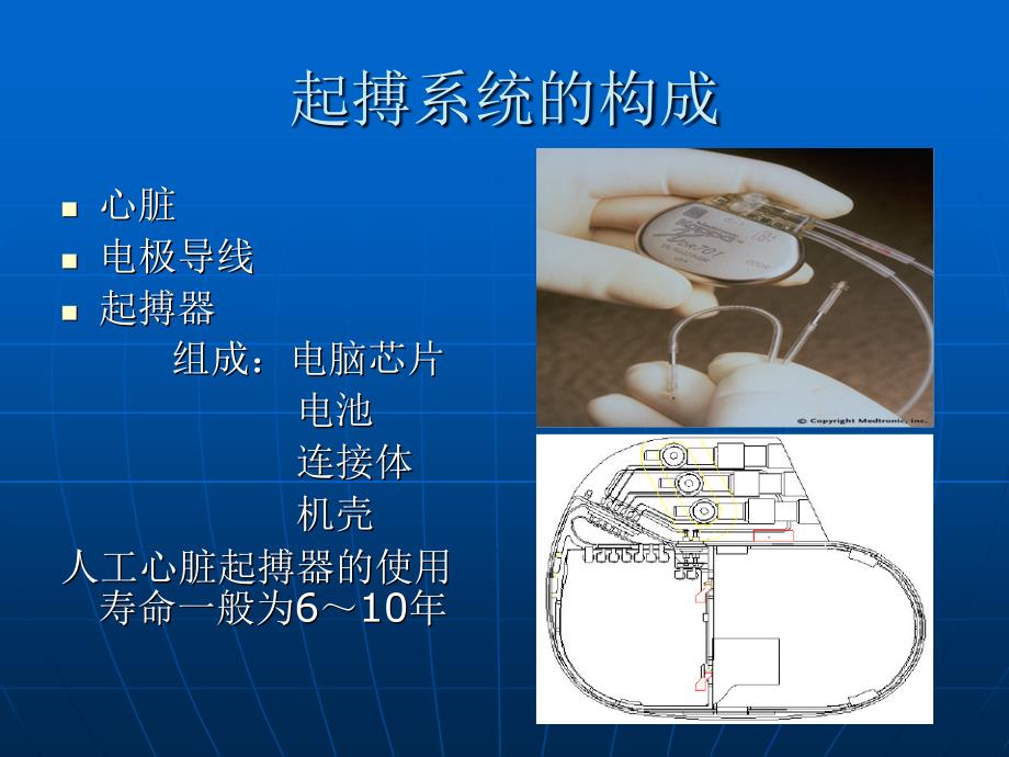 起搏器电池节能新技术_第2页