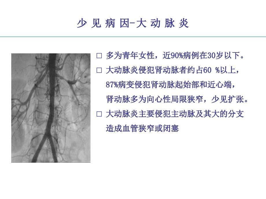 肾动脉支架术随机临床试验与临床实践的矛盾与统一_第5页