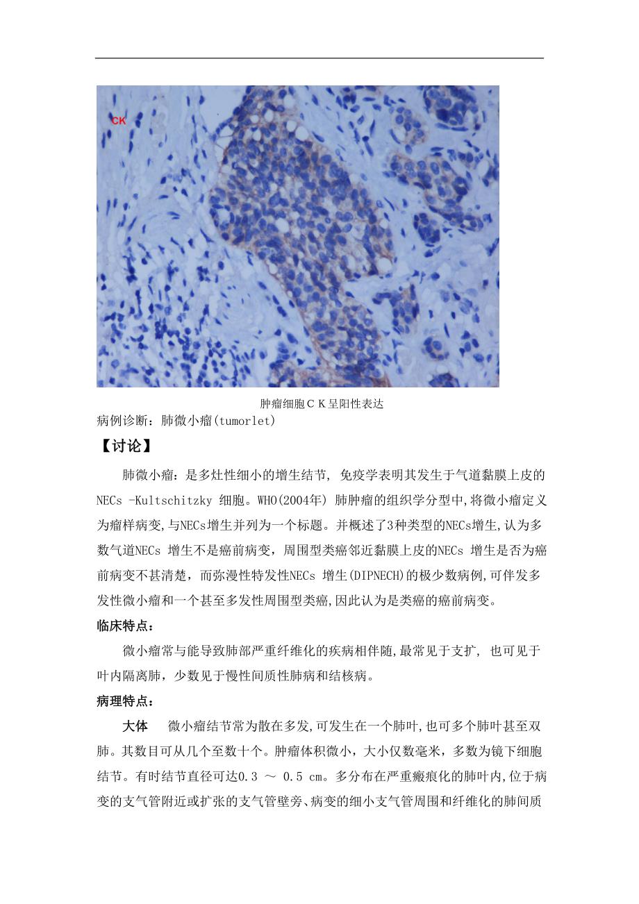 少见肿瘤病理读片精选(一)_第3页