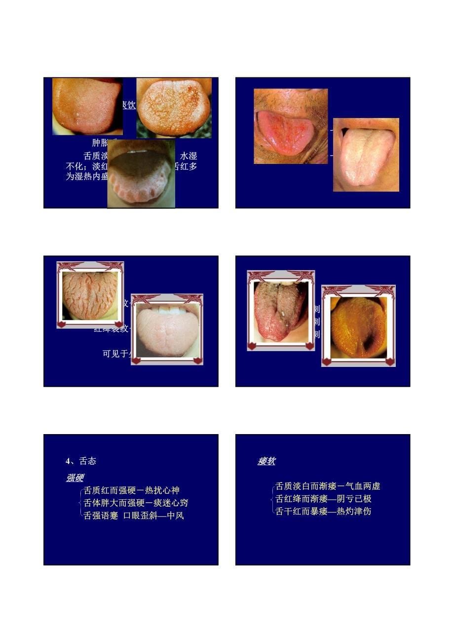 7舌诊部分 基础中医学_第5页