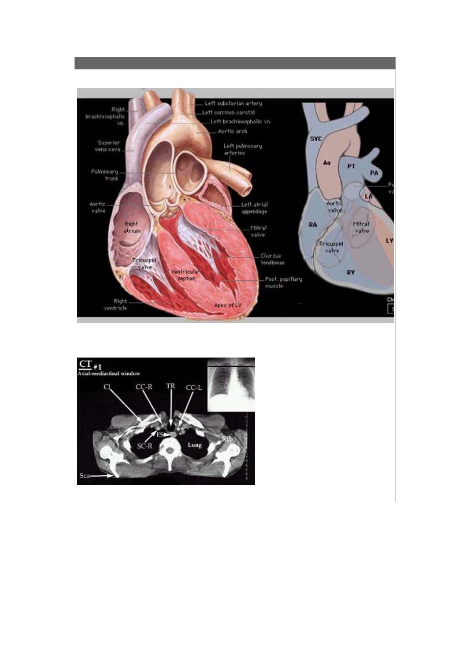 ct断层解剖图胸部-心脏_第1页