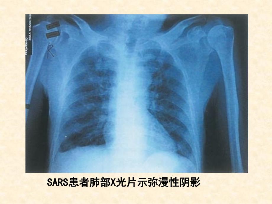 高中生物人教版必修一1.1《从生物圈到细胞》课件(45张)_第3页