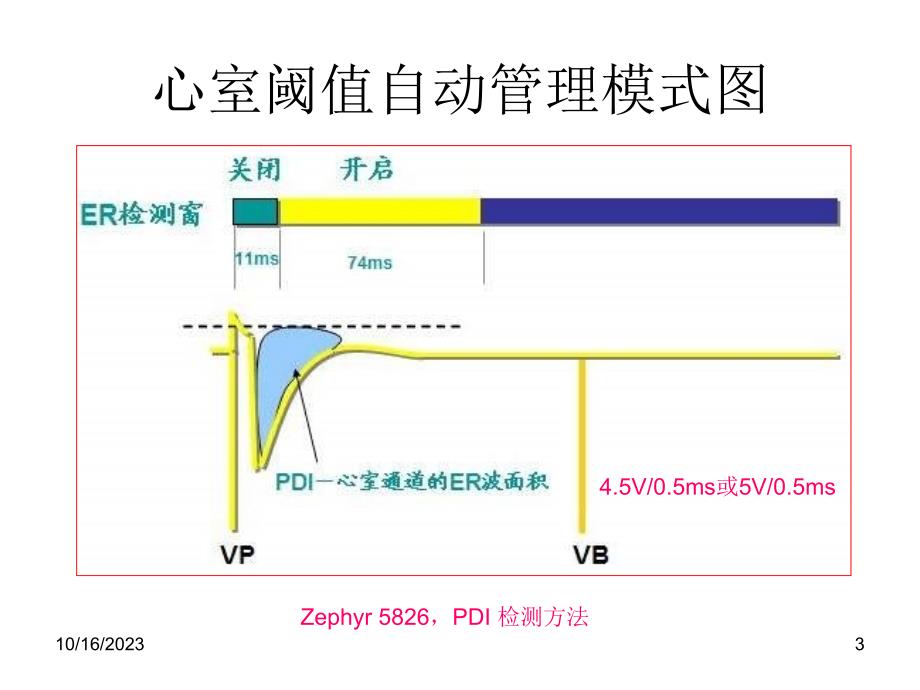 起搏器心室阈值自动管理功能相关的心电学特点课件_第3页