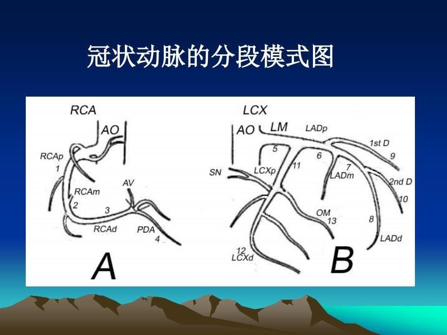 多层螺旋ct心脏成像ctca在冠心病诊治中的应用价值_第5页