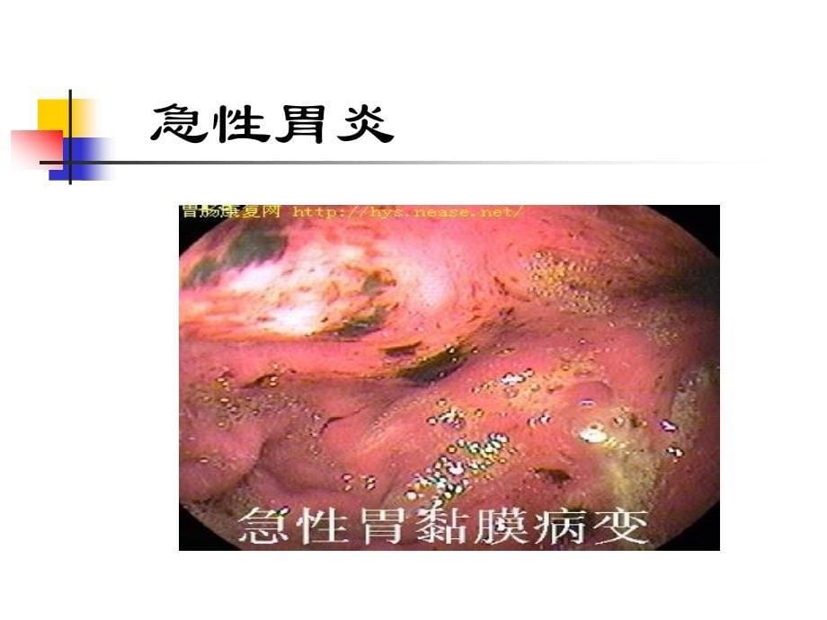 姜政重庆医科大学附一院消化内科_第5页