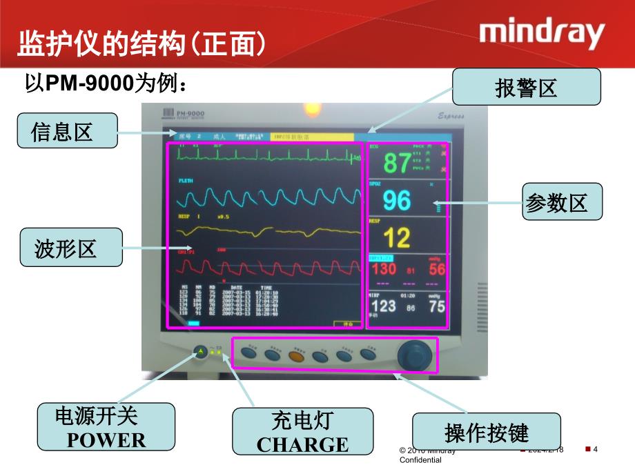 监护仪客户培训_第4页