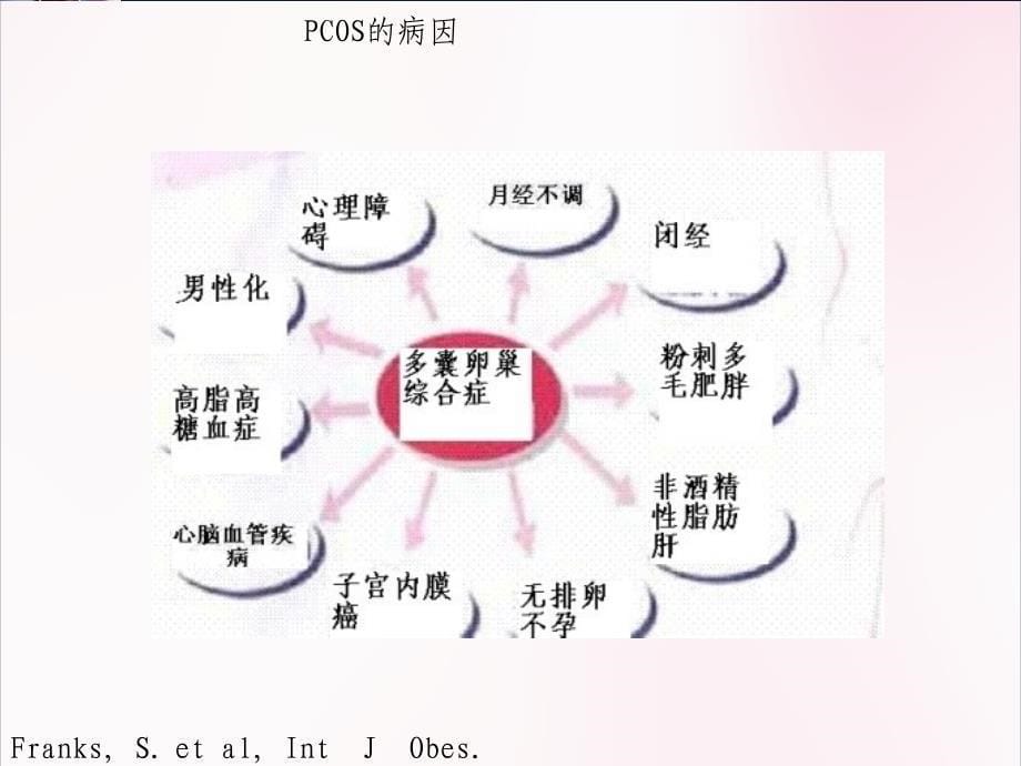 医学 多囊卵巢综合征课件ppt课件_第5页