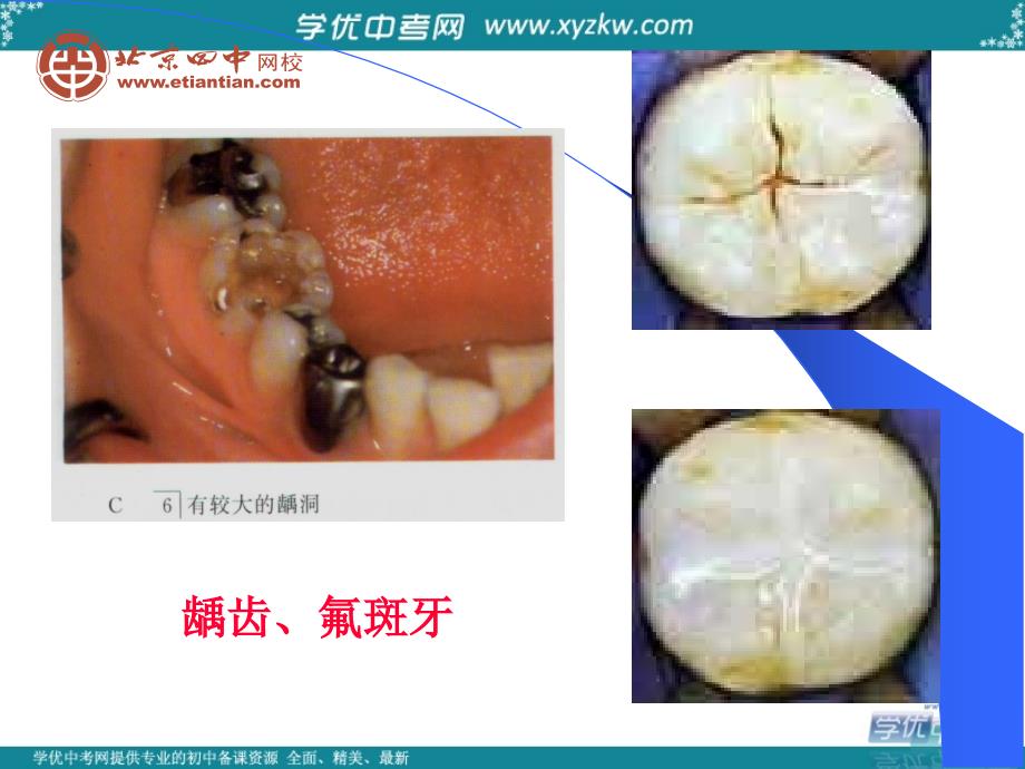 辽宁省铁岭县莲花中学中考化学总复习 第十二单元 化学与生活 课题2 化学元素与人体健康课件（4）.ppt_第3页