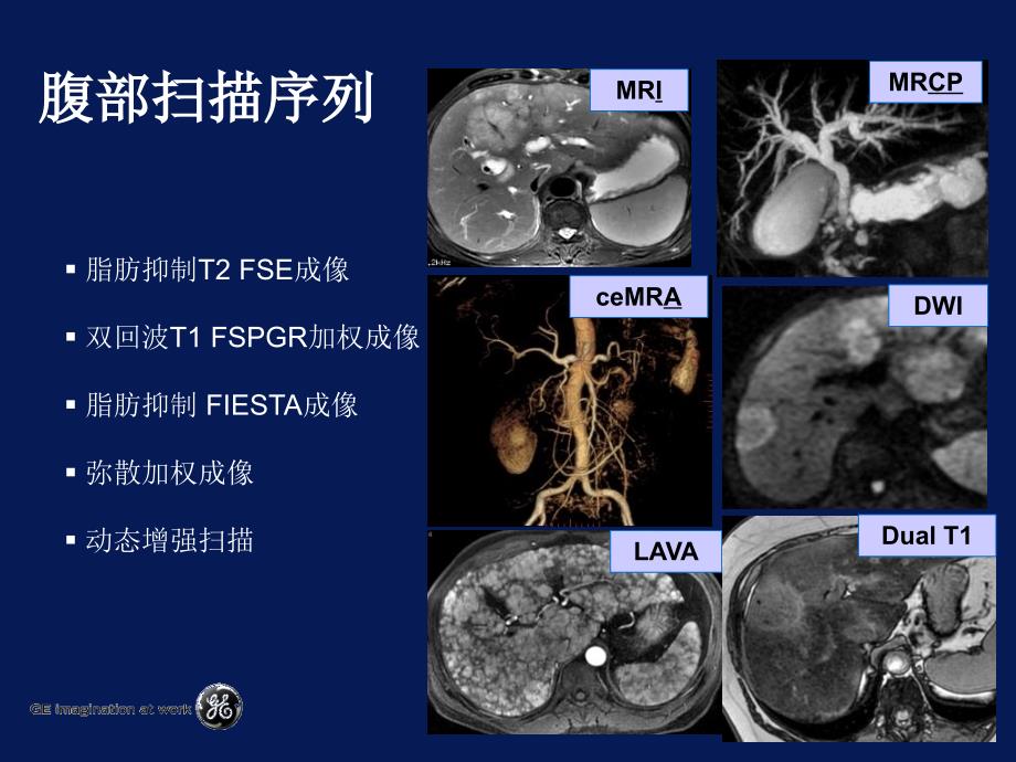 《腹部方法》ppt课件_第3页