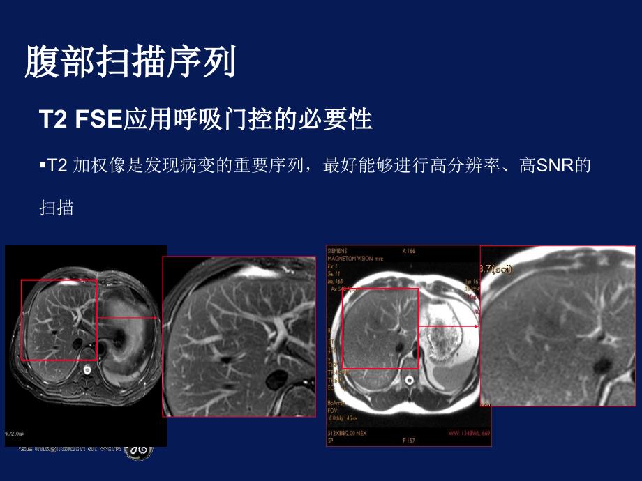 《腹部方法》ppt课件_第4页