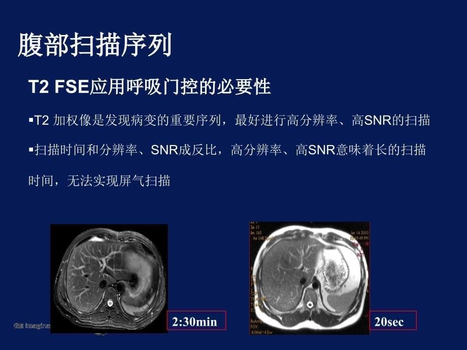 《腹部方法》ppt课件_第5页