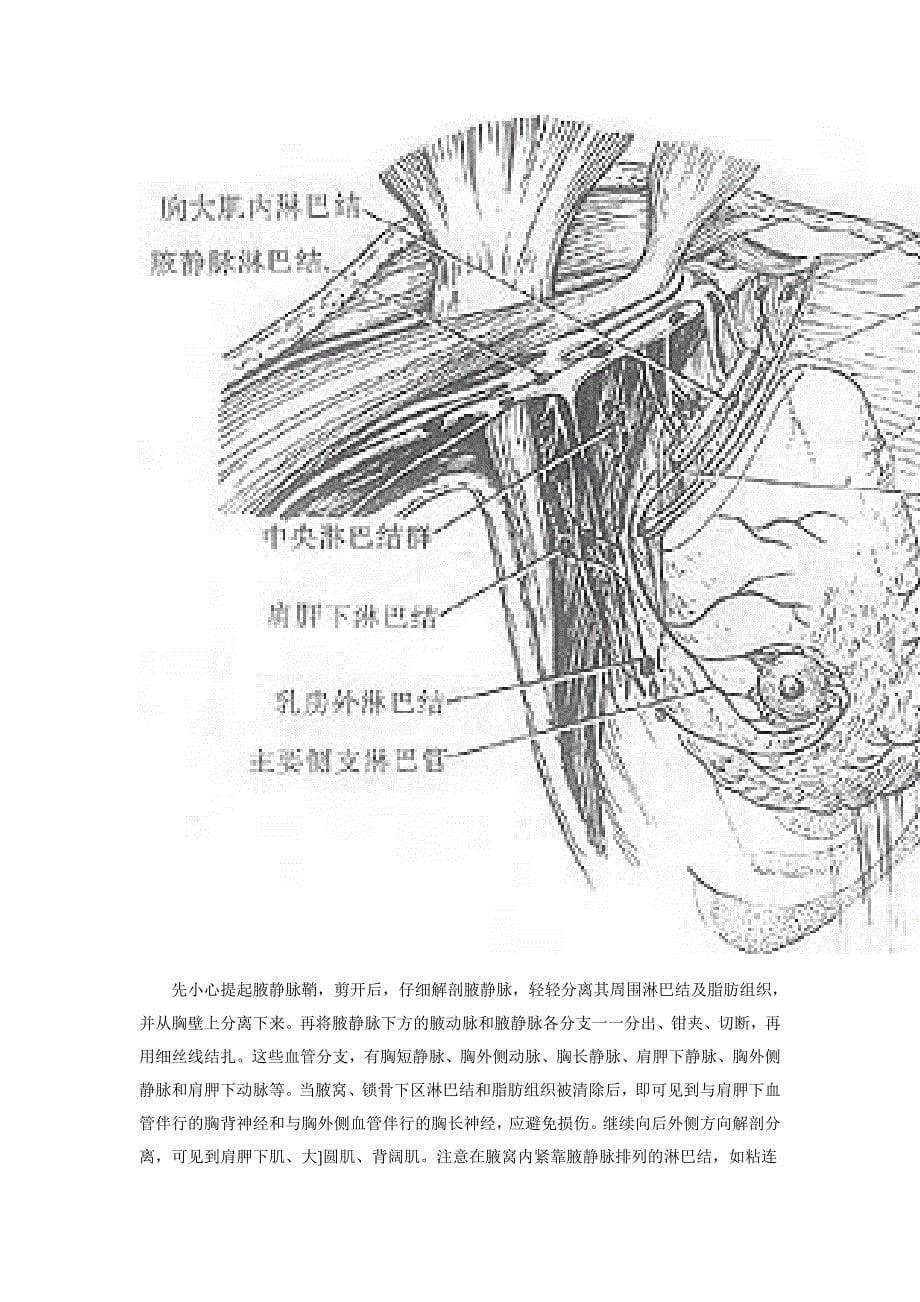 乳腺癌手术步骤_第5页