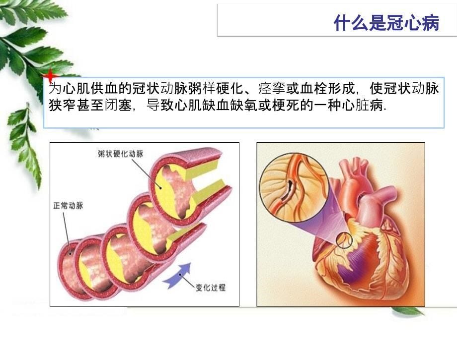 冠心病患教课要求ppt课件_第5页