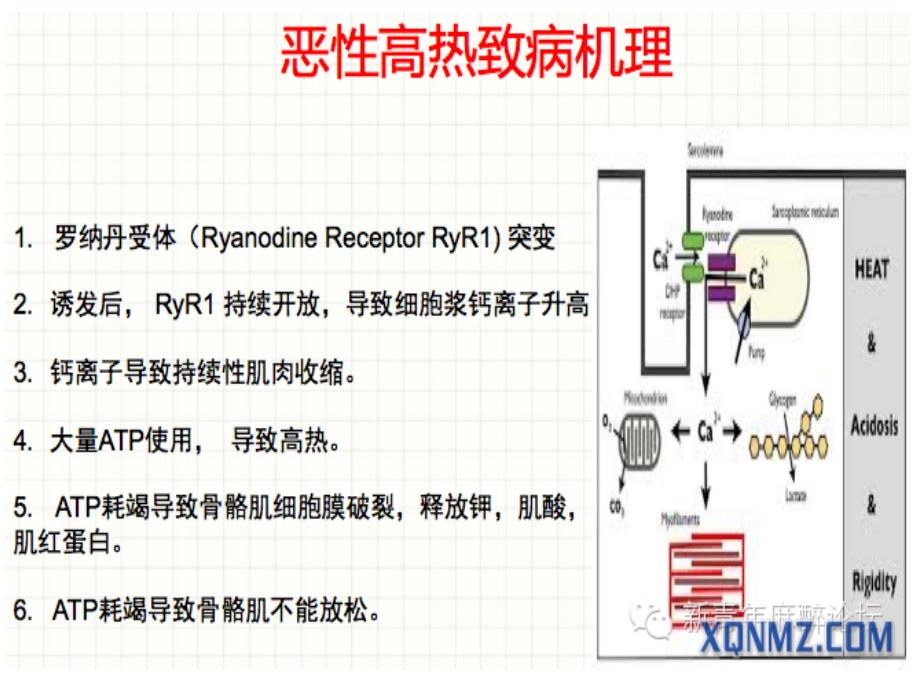 恶性高热简单版ppt课件_第4页