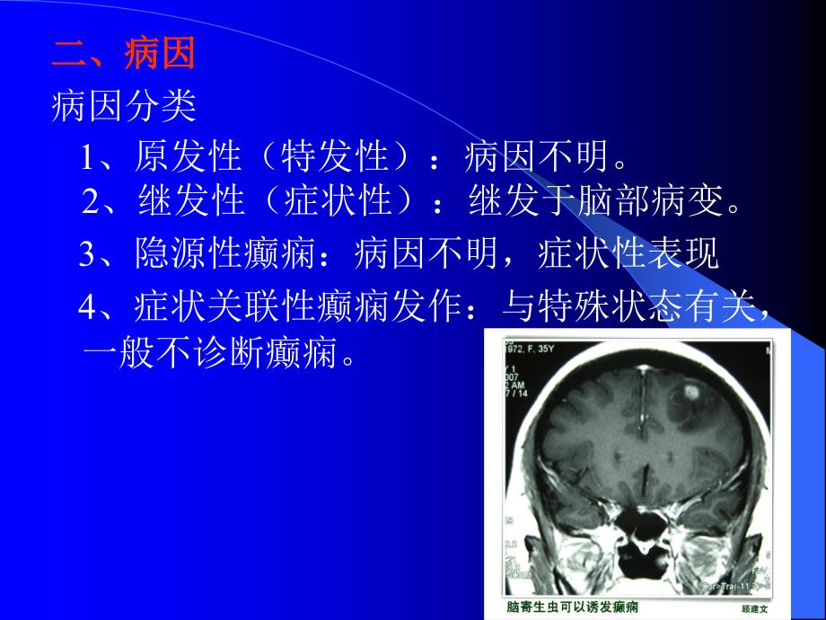 癫痫病的护理知识介绍ppt课件_第3页