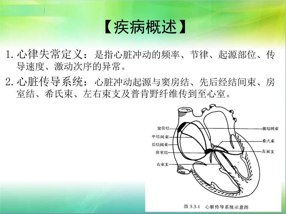 聂春华医生详解_心律失常病人的护理_第3页