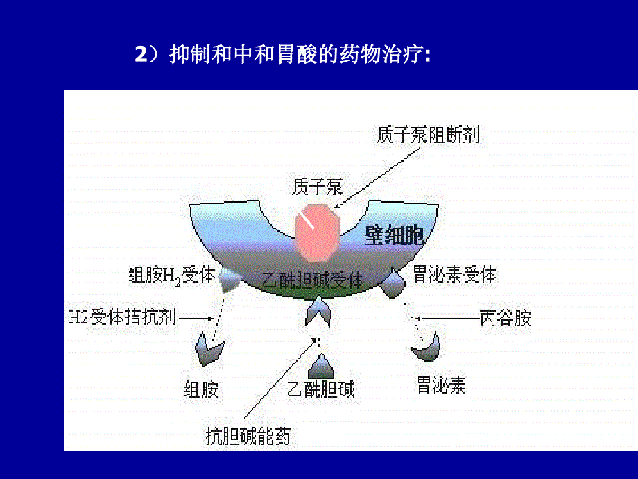 胃炎 gastritis_第2页