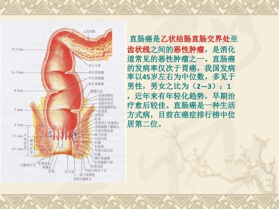 直肠癌保肛术并发肠瘘ppt课件_第5页