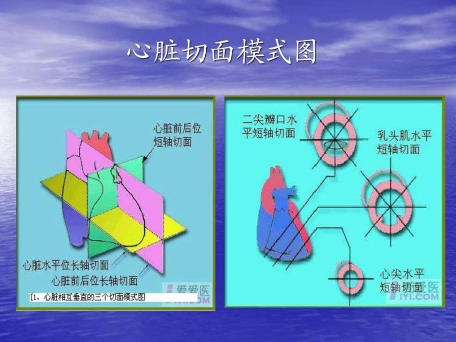 心脏超声切面示意_第2页